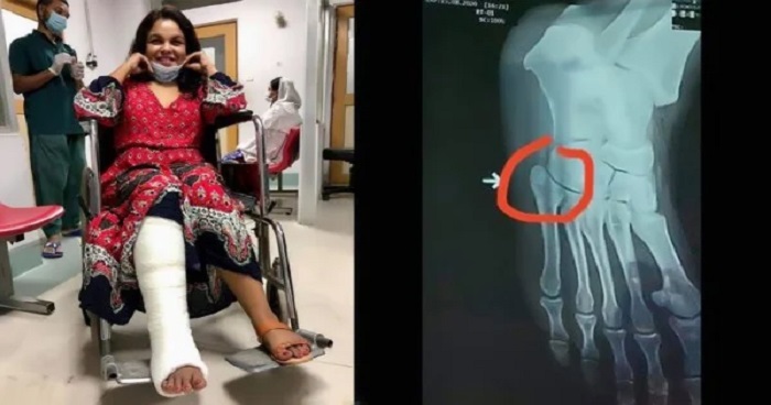 পায়ে চিড় হয়েছে শাওনের, রয়েছেন বিশ্রামে পায়ে চিড় হয়েছে শাওনের, রয়েছেন বিশ্রামে