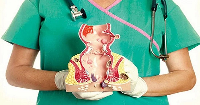 পায়ুপথের বিভিন্ন সমস্যা প্রতিরোধে যা করবেন পায়ুপথের বিভিন্ন সমস্যা প্রতিরোধে যা করবেন