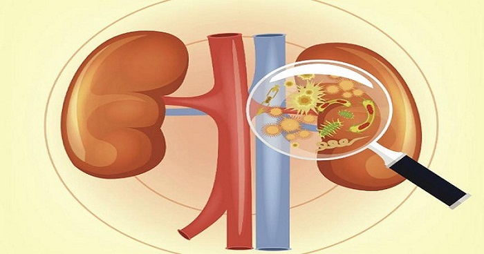 যাদের কিডনি রোগে আক্রান্ত হওয়ার ঝুঁকি বেশি