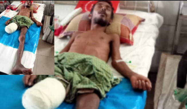 যুবদল নেতার মারপিটে পা হারালেন মানসিক প্রতিবন্ধি মেহেদী হাসান যুবদল নেতার মারপিটে পা হারালেন মানসিক প্রতিবন্ধি মেহেদী হাসান