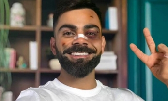 কোহলির এ কী হাল!