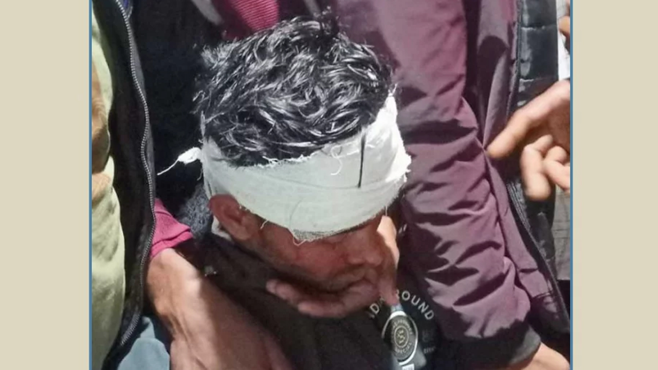 হান্নান মাসউদের পথসভায় ইট নিক্ষেপ, আহত ২