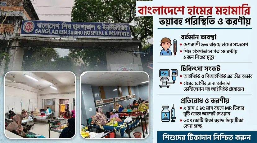 হামের ছোবলে দিশেহারা দেশ : শিশু হাসপাতালে আইসিইউ সংকটে বিপন্ন শৈশব!